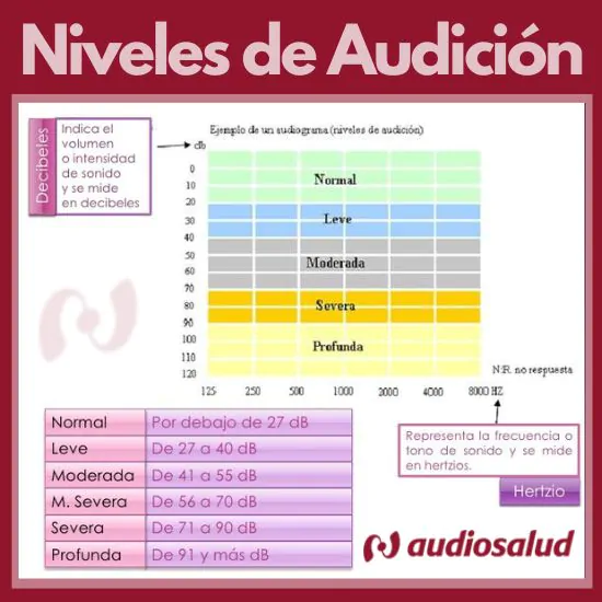 tabla de porcentaje de pérdida auditiva